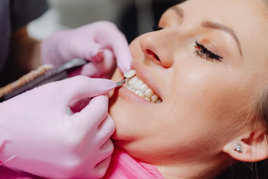 Dentist matching a crown shade to a patient’s teeth